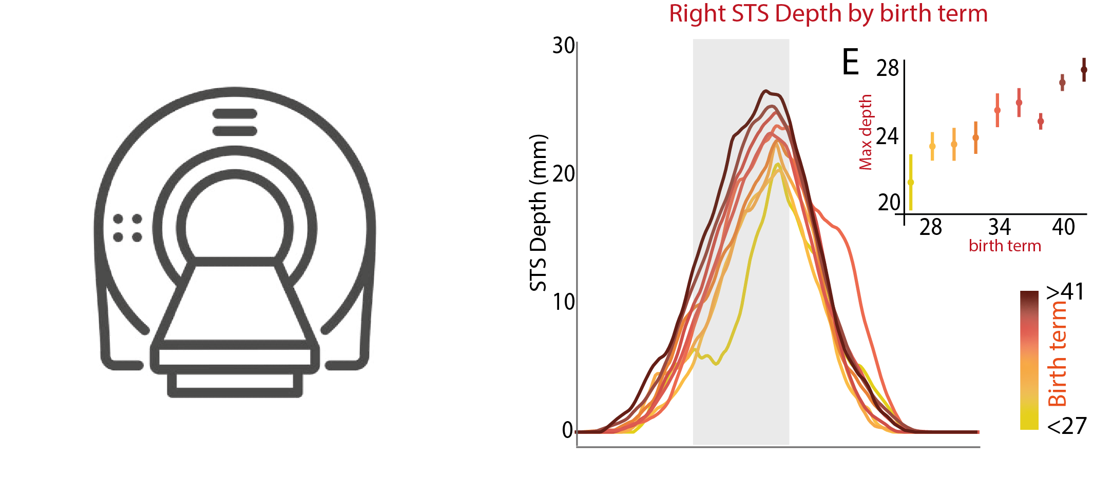 MRI scanner icon beside curves of right superior temporal sulcus depth as a function of birth term